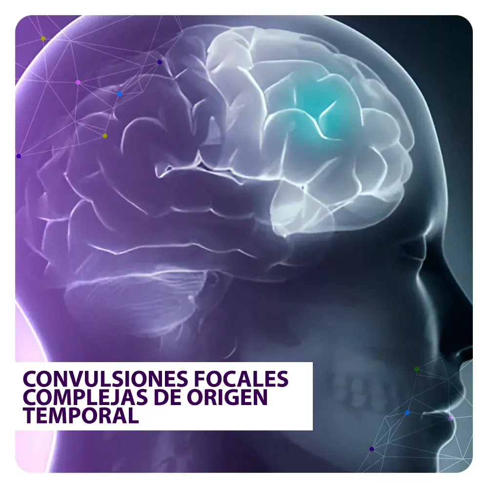 convulsiones focales complejas de origen temporal
