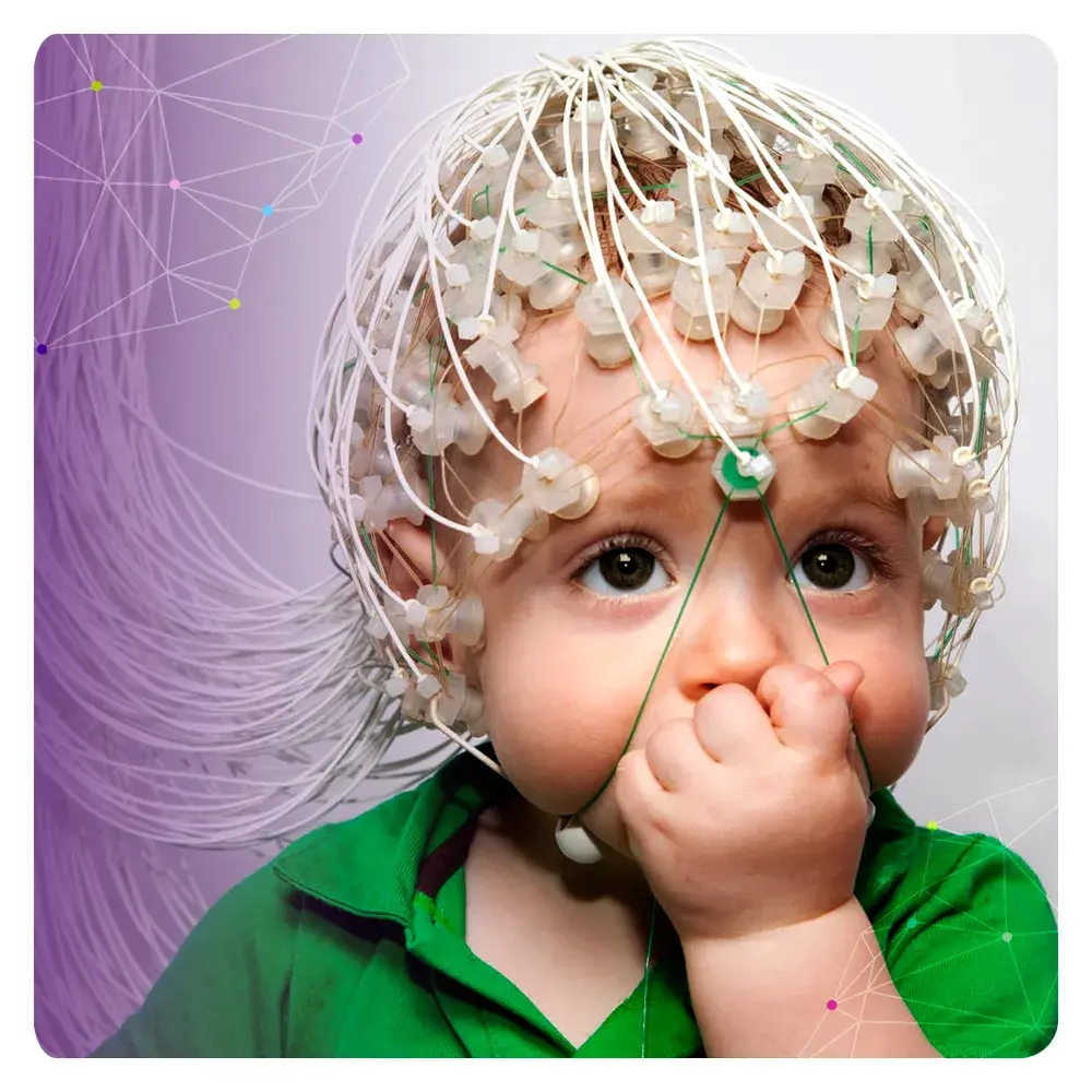 Electroencefalograma en cabeza de un bebé